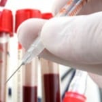 ICMR’s General Hopes for Cheaper Indian Diagnostic Tool for TB ICMR