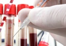 ICMR’s General Hopes for Cheaper Indian Diagnostic Tool for TB ICMR