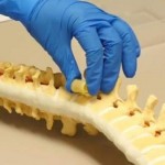 The Spine Gets a Spongy Support