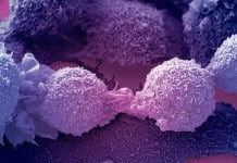 Cells Behaving Badly – New Study Shows how Cancer Cells Escape from Treatment