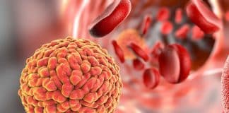 Microbiome Could Help Predict Cancer-Related Blood Infections