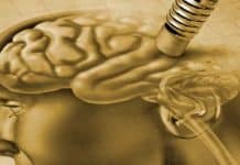 Drug For Reversing Genetic Changes Behind Alzheimer’s Already Exists