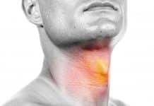 Oral Cancer may have an association with the bacterial colonies in human body