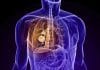 Scientists Develop New Method to Detect Mycobacteria in the Lungs
