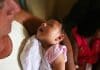 Zika virus Causes Microcephaly, Infects Brain Cells and Evade Immune System