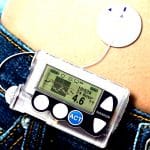 Bigfoot to perform first clinical trial of artificial pancreas