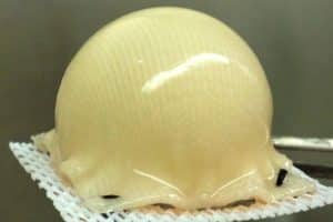 A scaffold molded into the precise shape of hip joint