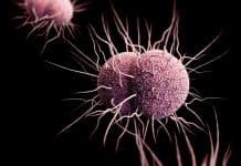 Scientists Warn Gonorrhea May Soon Become Untreatable