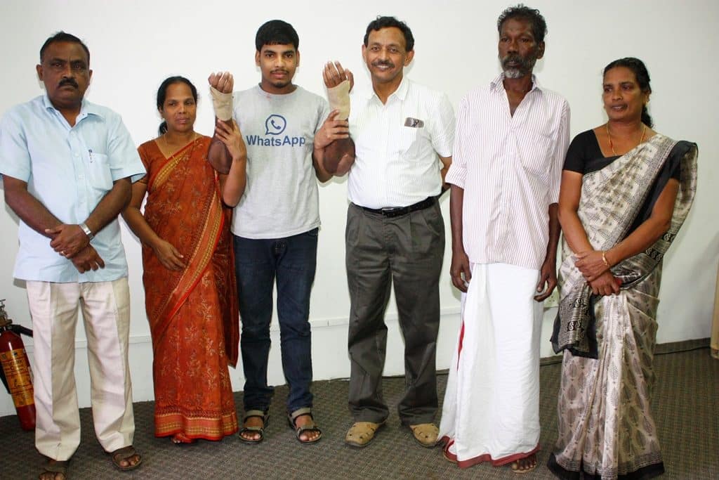 Pix 2 Elbow-Level Hand Transplant AIMS Kochi