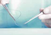 Smart Thread Helps Collect Information When Sutured To Skin