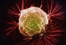 The Stem (Cell) Of The Problem – Tracking The Origin Of Skin Cancer