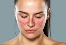 Biogen’s New Lupus Drug To Undergo Initial Testing Next Year