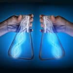 Untangling The Sticky Biosimilar Web – How Indian Companies Should Exploit This Frontier