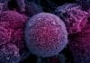 Lab-grown “Mini Tumors” to Help Tailor Cancer Treatment Deep Buried Link between Extrachromosomal DNA and Tumors Unearthed
