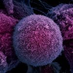 Deep Buried Link between Extrachromosomal DNA and Tumors Unearthed