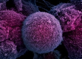 Deep Buried Link between Extrachromosomal DNA and Tumors Unearthed Deep Buried Link between Extrachromosomal DNA and Tumors Unearthed