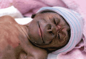 humanzee