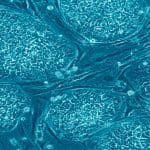 Study Provides Insights on Origin of Cancer through Mature Cell Discovery