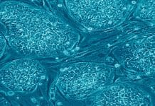 Study Provides Insights on Origin of Cancer through Mature Cell Discovery