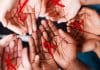 Using CAR T-Cells To Treat HIV Shows Promising Results