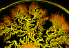 How Preventing Bacterial Biofilms Could Prevent Disease Altogether