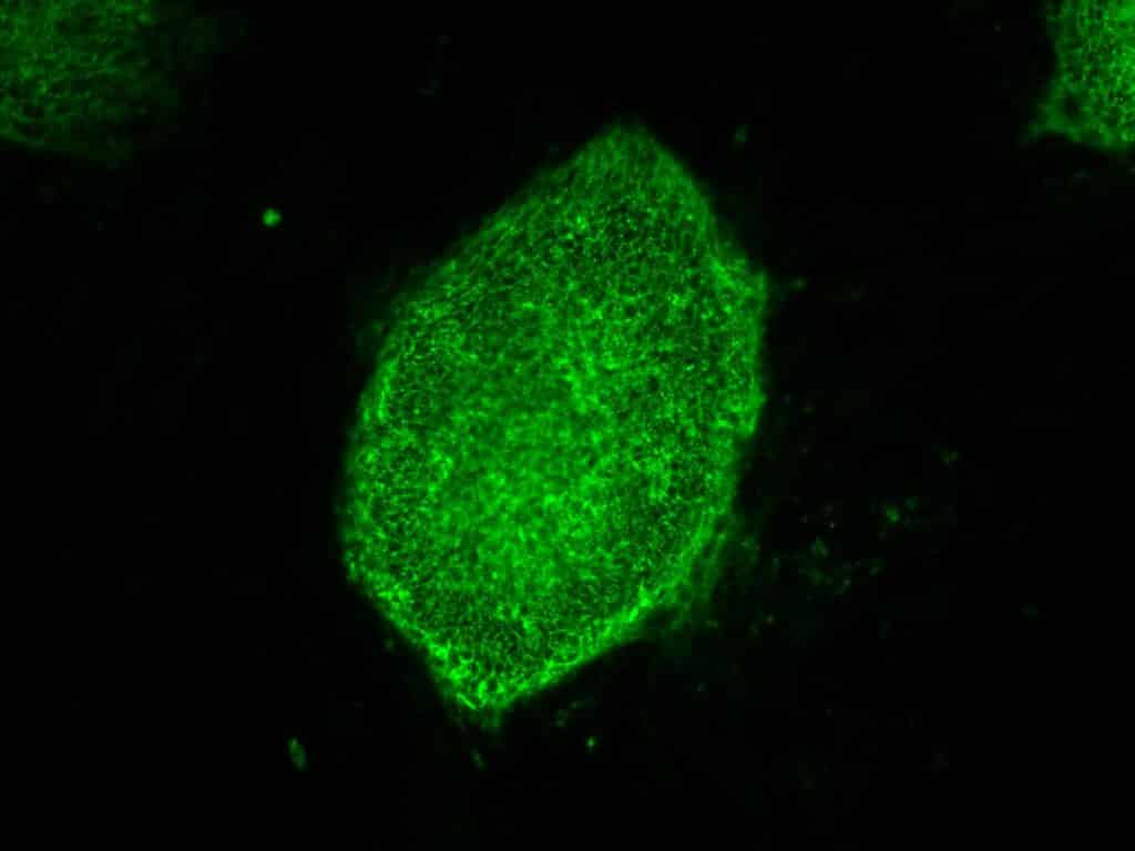IMAGE COURTESY OF STEPHEN A. DUNCAN, PH.D., AT THE MEDICAL UNIVERSITY OF SOUTH CAROLINA.