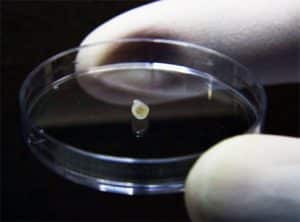 A midbrain organoid in a petri dish. The black pigment is neuromelanin, a hallmark of the human midbrain. Credit: Image courtesy of The Agency for Science, Technology and Research (A*STAR)