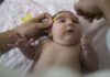 Brain Damage Through Zika Virus’ Congenital Infection Goes Beyond Microcephaly