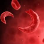 CRISPRs Point Way to New Sickle Cell Disease Therapies