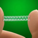 Cardiologists Ponder On The Future Of Bioresorbable Stents In The US