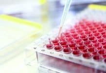 How Cell-Based Assays Can Be Effectively Used In Drug Screens Or Precision Medicine