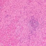 Govt Job @ Institute of Liver & Biliary Sciences | JRF & SRF Post Vacant