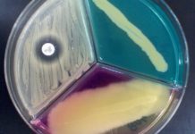 Bright Idea for Detecting Harmful Bacteria in Food Products