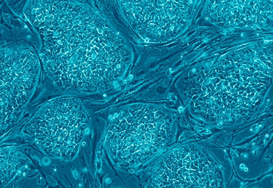 Primary Trial of Anti-Aging Stem Cell Treatment Displays Impressive Results