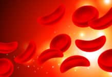 CRISPR/Cas9 Corrects Sickle Cell Mutation