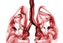 Jubilant Life Awarded Australia TGA Nod for Lung Scan Drug