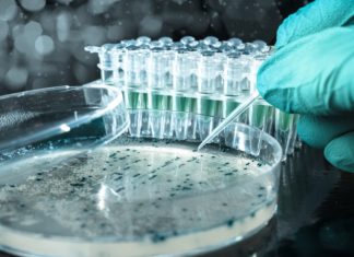 Researches Use AI to Quickly and Accurately Identify Bacteria Researches Use AI to Quickly and Accurately Identify Bacteria