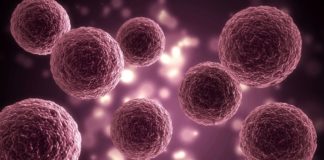 Breast Cancer’s Methionine Dependency, Offers Potential Treatment Ways