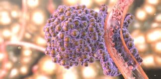 Analysis of Pixelated Spatial Gene Expression - Rapid Cancer Recognition