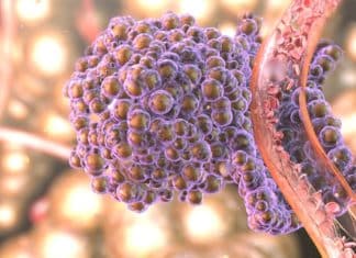 Analysis of Pixelated Spatial Gene Expression - Rapid Cancer Recognition