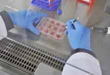 Post Doctoral Position in Stem Cell Vacant @ Department of Biotech, Era’s Lucknow Medical College & Hospital, Era University