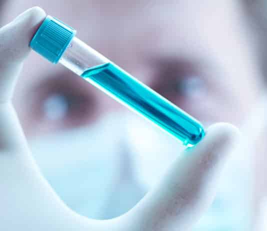 Walk in Interview For Microbiology Candidates @ Otsuka Pharmaceutical DBT Funded Research Scientist & Associate Posts