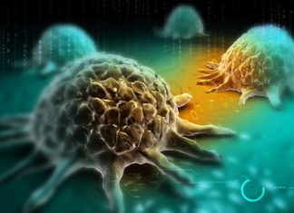 “Resolvin” Cancer by Clearing Accumulated Debris of Tumour Cells “Resolvin” Cancer by Clearing Accumulated Debris of Tumour Cells