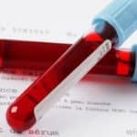 Are you susceptible to Cancer? Now, a simple blood test can answer this question for you!
