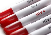 A Child Has Been Virtually Cured Of HIV Form Past 9 Years & Counting… !