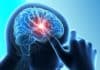 IBM’s Watson Comes To Aid : To Help Tackle Brain Tumour Stem-Cell-based Stroke Treatment Found to Reduce Brain Damage