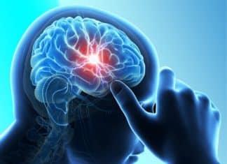 Stem-Cell-based Stroke Treatment Found to Reduce Brain Damage