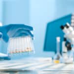 R&D MSc Jobs Vacancies @ Panacea Biotec | Work in Upstream Processing R&D MSc Jobs Vacancies @ Panacea Biotec