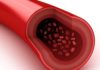 Scientists Devise a Technique To Detect Arterial Damage Even Before Heart Disease Strikes