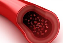 Scientists Devise a Technique To Detect Arterial Damage Even Before Heart Disease Strikes